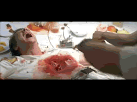 Forum Image: http://i160.photobucket.com/albums/t166/Spinningfox/4Chan/000070rx.gif
