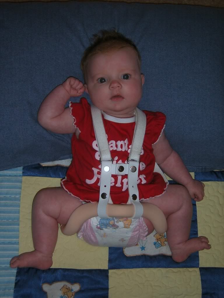 Hip kids/Hip Dysplasia Support Group Page 2 Babies and Kids With