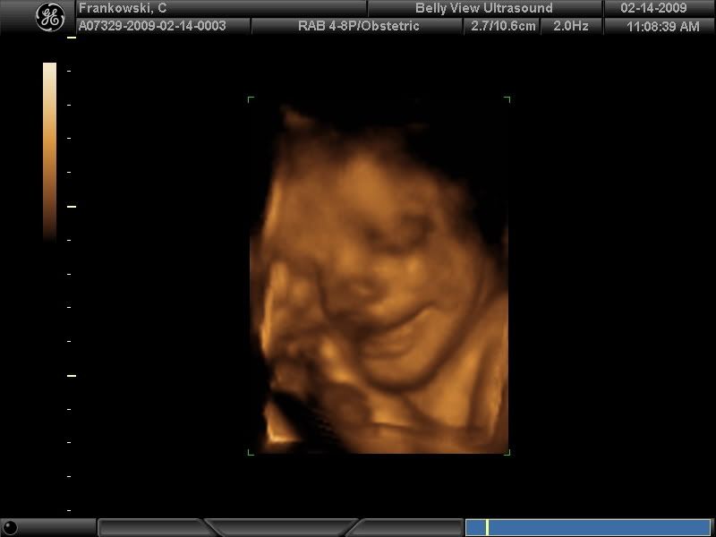 3d ultrasound pictures at 12 weeks. 3d ultrasound 12 weeks